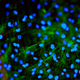 Human mesenchymal stem cells (Image: Rose Spear/Flickr)